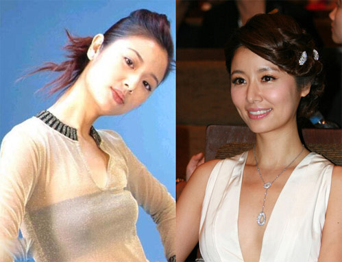 林心如隆胸前后照,林心如曾饰演《还珠格格》紫薇一角走红娱乐圈时