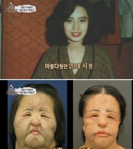 摘要:美女整容变成"电风扇大妈",毁的还是比较彻底得.