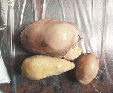 听人说"鸡宝"价值连城,一克价格在7万元到35万元之间,黄女士一家可