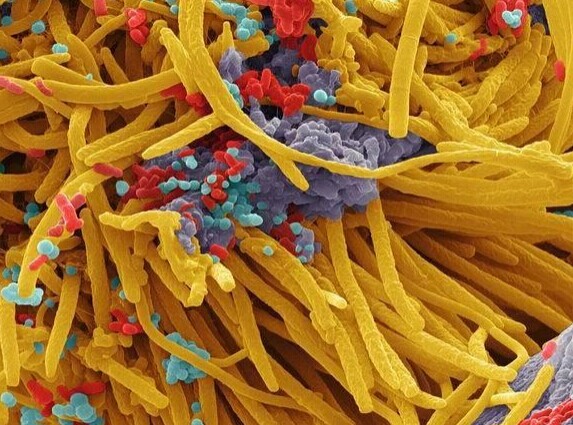 你知道吗：这些“细菌怪兽”生活在你的口腔里