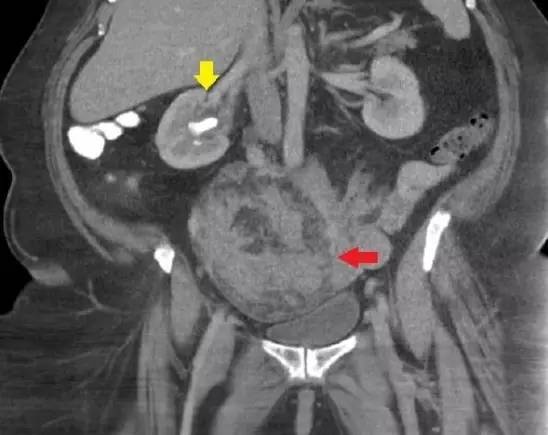 1dc95f0724023ccb37bcd43fddfbc1c.jpg?_=1471999039957