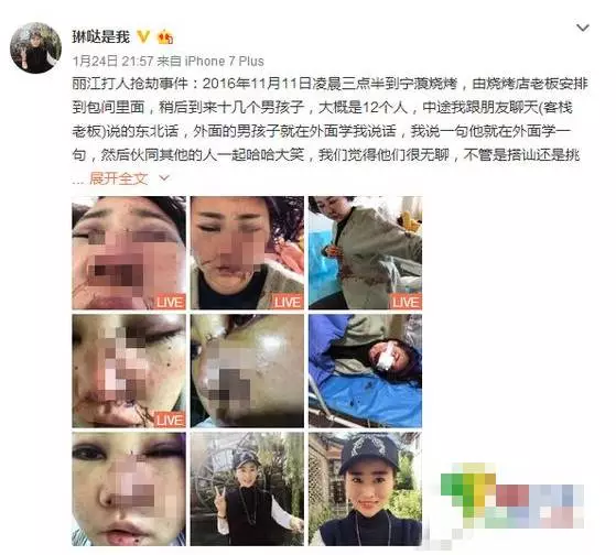 丽江被打毁容女孩公开近照 绝望时曾留下遗书割腕自杀