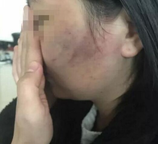 女生深夜遭围殴 因被怀疑说别人坏话