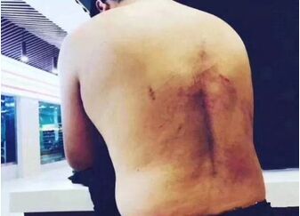 记者被十余名男子殴打后关进太平间