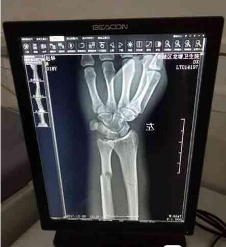 中国第一碰瓷天团:分区作战 6个团伙瓜分市场