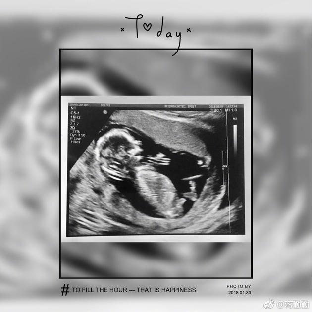 42岁蒋勤勤承认怀二胎:虎儿终于有伴了