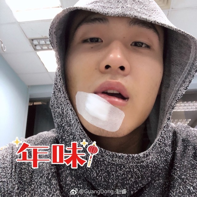 赵睿过年受伤破相被缝5针 队友：好美
