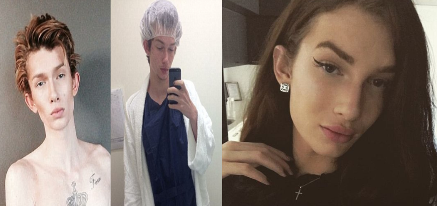 小伙花43万整容 和男人100次约会后惊觉自己喜欢女生