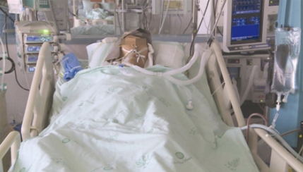 洗冷水澡患肝衰竭 肝移植成唯一救命办法