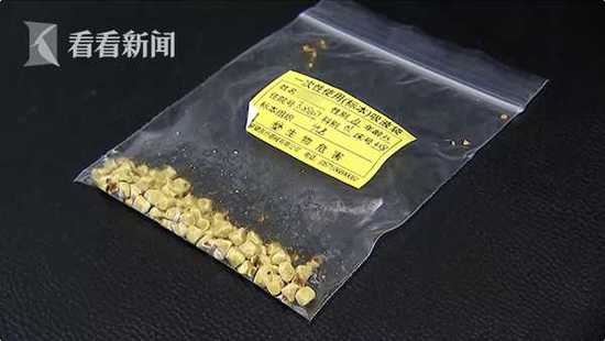 吃鹅蛋取出80颗结石 真的是吃鹅蛋吃出来的?