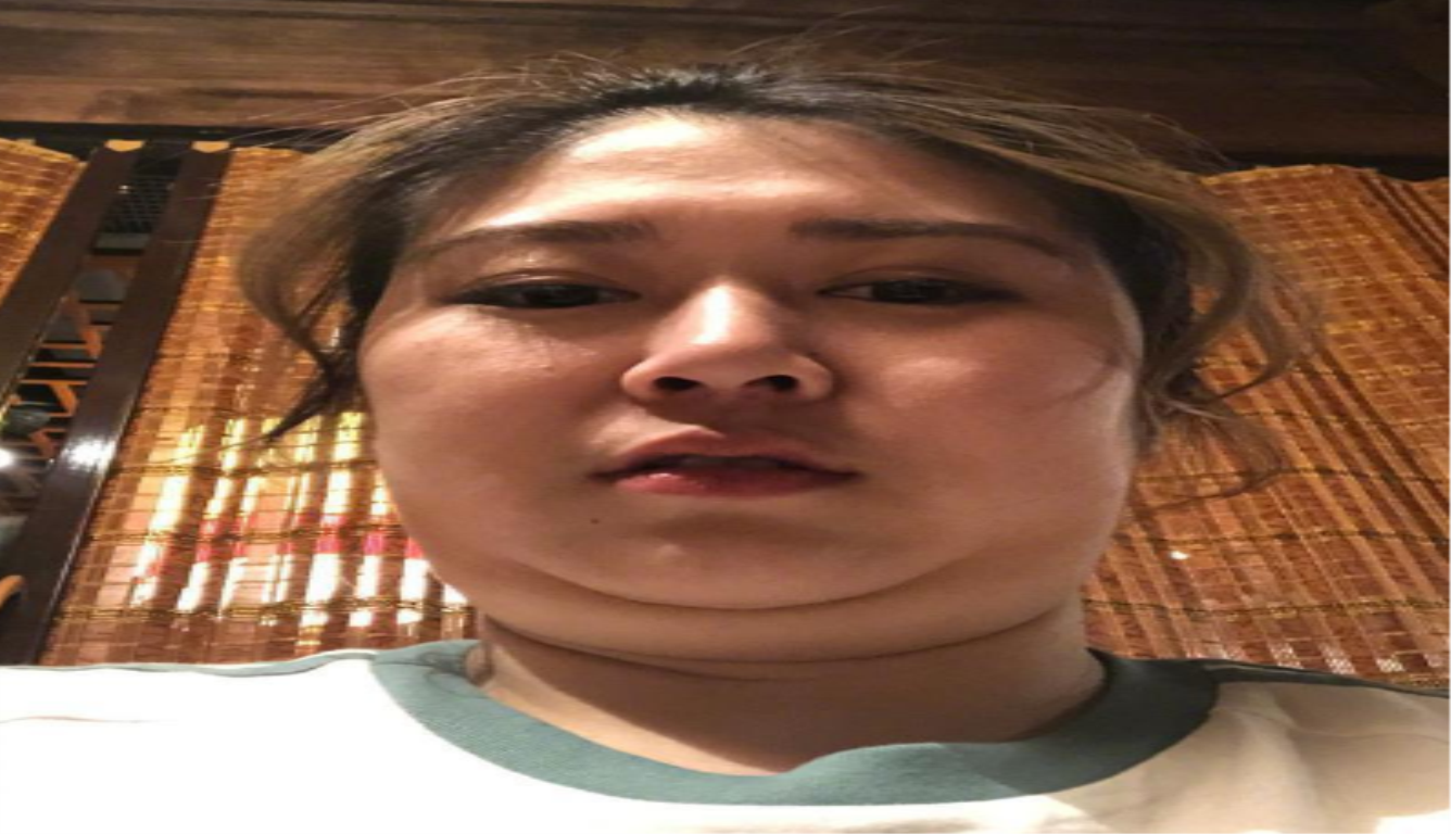 张雨绮双下巴自拍 称有些事情不是努力就能做到