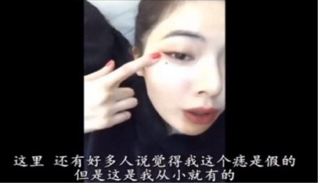 泫雅否认整容:只是容易脸肿而已