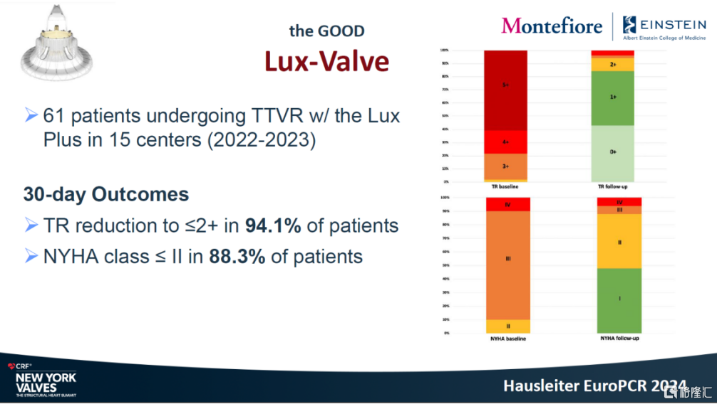 健世科技-B（9877.HK）：6个月期临床数据揭晓，LuX-Valve Plus彰显全球价值