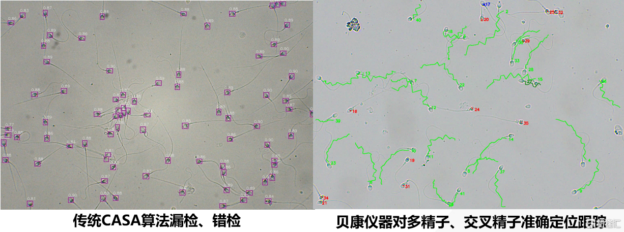 全球首款活精子检测仪器上市！贝康医疗-B(2170.HK)智能精子分析仪有望替代传统CASA诊断模式！